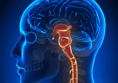 Understanding Key Brain Systems in Hypo and Hyperarousal in PTSD – Implications for Post-COVID Syndrome
